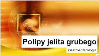 Polipy jelita grubego - przyczyny, objawy i leczenie