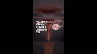 ¡Padecimientos hormonales que impiden tu pérdida de peso! - BAC