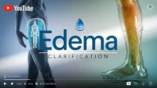 Edema Classification || General Pathology || Pathology Past Papers || Robbins || Hemodynamics