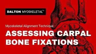 Carpal Bone Fixation Assessment Massage Technique, the MAT Way