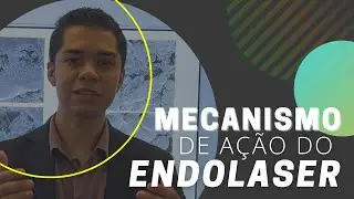 Como funciona a técnica do ENDOLASER??