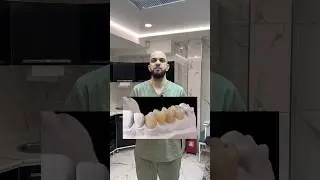 Циркониевые коронки #коронки #циркон