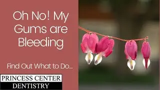 Oh No! My Gums are Bleeding! (Find Out What to Do...)