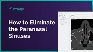 How to Eliminate the Paranasal Sinuses | Flowgy Academy