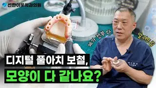 [2탄] 디지털 풀아치 보철 모양은 전부 같은 틀에 찍혀서 나온다?🙄 ㅣ디지털 풀아치 보철의 모양에 대한 A to Z