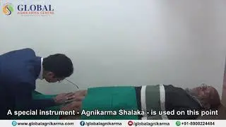 Agnikarma Procedure | Ayurvedic treatment for Joint Pain @Global Agnikarma Centre