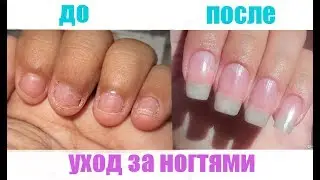Как ОТРАСТИТЬ ногти за 3 ДНЯ | УХОД за ногтями // УКРЕПЛЕНИЕ ногтей 