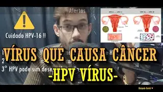 Vírus que causa câncer - Vírus HPV