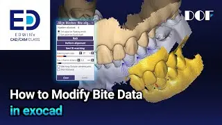 How to Modify Bite Data in exocad