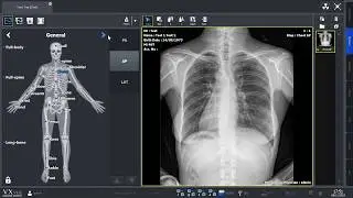 Human - Demo VxVue