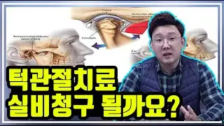 턱관절 치료, 실비 청구 가능할까요?