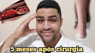 MINHA CIRURGIA DO TENDÃO CALCÂNEO E TROMBOSE!