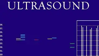 Gravis Ultrasound - Pro Patches Lite - PSR510_4.MID