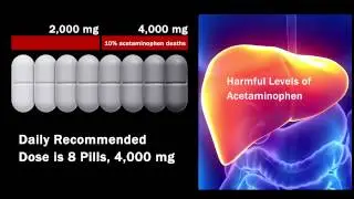 Tylenol, the Most Dangerous Over-the-Counter Drug? Part II