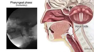 Normal swallowing for USMLE.