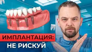 Импланты: кому нельзя и почему?
