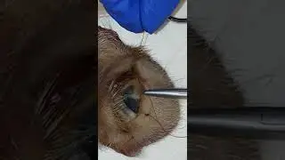 Figure of 8 Suture