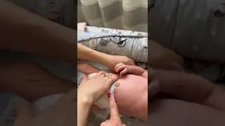 Современный подход к уходу за пупком новорожденного. Читай описание к видео