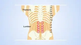 How DRG stimulation at T12 reveals the transmission of low back pain in the spinal cord: The theory