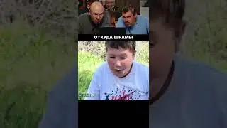 Where do these scars come from?