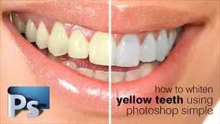 How to Whiten Teeth in Photoshop Simple