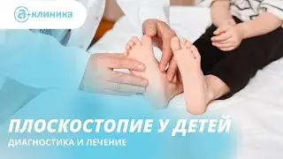 Flat feet in children. Diagnosis and treatment