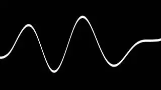 【belly noises】Active Peristalsis noise (large intestine)