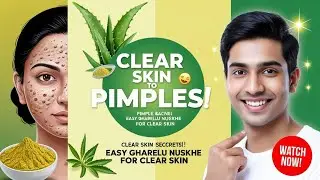 Pimples Aur Acne Ko Kaho Bye-Bye 🌟 Glowing Skin Ke Liye 🌿