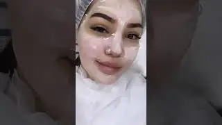 Чистка лица 