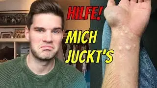 Hilfe mich Juckt's - Das habe ich unternommen