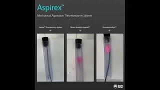 AspirexTM Mechanical Aspiration Thrombectomy System Bench Comparison