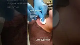 Пирсинг на шее. Микродермал. Подкожный пирсинг на шее. Студия пирсинга и тату Эво.