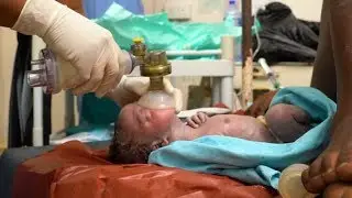 Helping Babies Breathe at Birth - Newborn Care Series