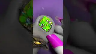 Отпал ноготь?😱Педикюр.Вросший ноготь.Что делать? #nails #tutorial #nailart #дизайнногтей #pedicure