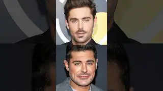 Zac Efron’s New Look: Surgeons Set the Record Straight #zacefron