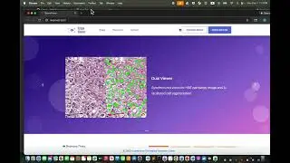 Set up ScopeViewer locally in under 2 minutes
