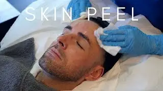 Obagi Blue Peel Radiance | The Laser and Skin Clinic