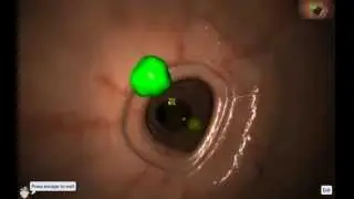 EndoSim Fundamental Endoscopy Skills 1: Button Handling