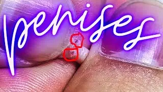 How To Sex Tiny Snakes