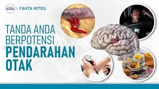 Sering Diabaikan, Hal-hal Ini Berpotensi Picu Pendarahan Otak! | Hidup Sehat tvOne