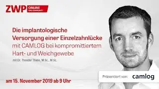 Die implantologische Versorgung einer Einzelzahnlücke mit CAMLOG