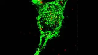 Watching virus-like particles in a cell