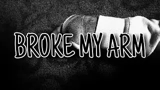 I BROKE MY ARM!