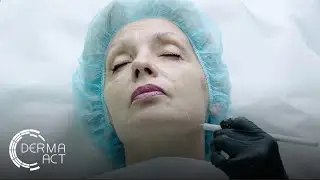 Поставяне на филъри за цяло лице