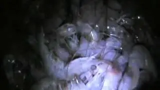 #1