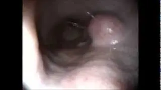 גסטרוסקופיה ומה שבדרך..