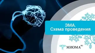 ЭМА. Схема проведения Эмболизации