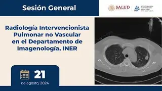 SESIÓN GENERAL: Radiología Intervencionista Pulmonar no Vascular en el Departamento de Imagenología