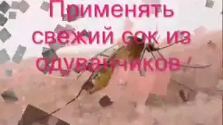 Народные средства от бородавок: 1 часть
