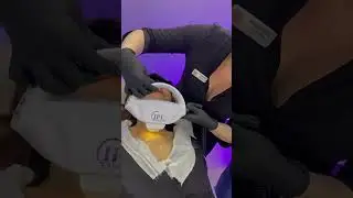 фототерапия IPL LUMENIS QUANTUM